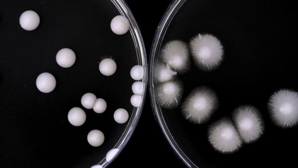 This image was taken at the Mycology Laboratory, Royal Dental Hospital of Melbourne, situated on the lands of the Wurundjeri people of the Kulin Nation, in May 2026. It shows Candida albicans colonies cultured from oral swabs of two patient groups: those with inflammatory oral mucosal disease (left, smooth round colonies) and those with oral cancer (right, colonies with distinctive spiky, filamentous edges).