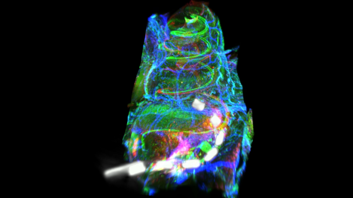 An intricate image of a cochlear implant interfacing with a cochlea, lit in fluorescent colours